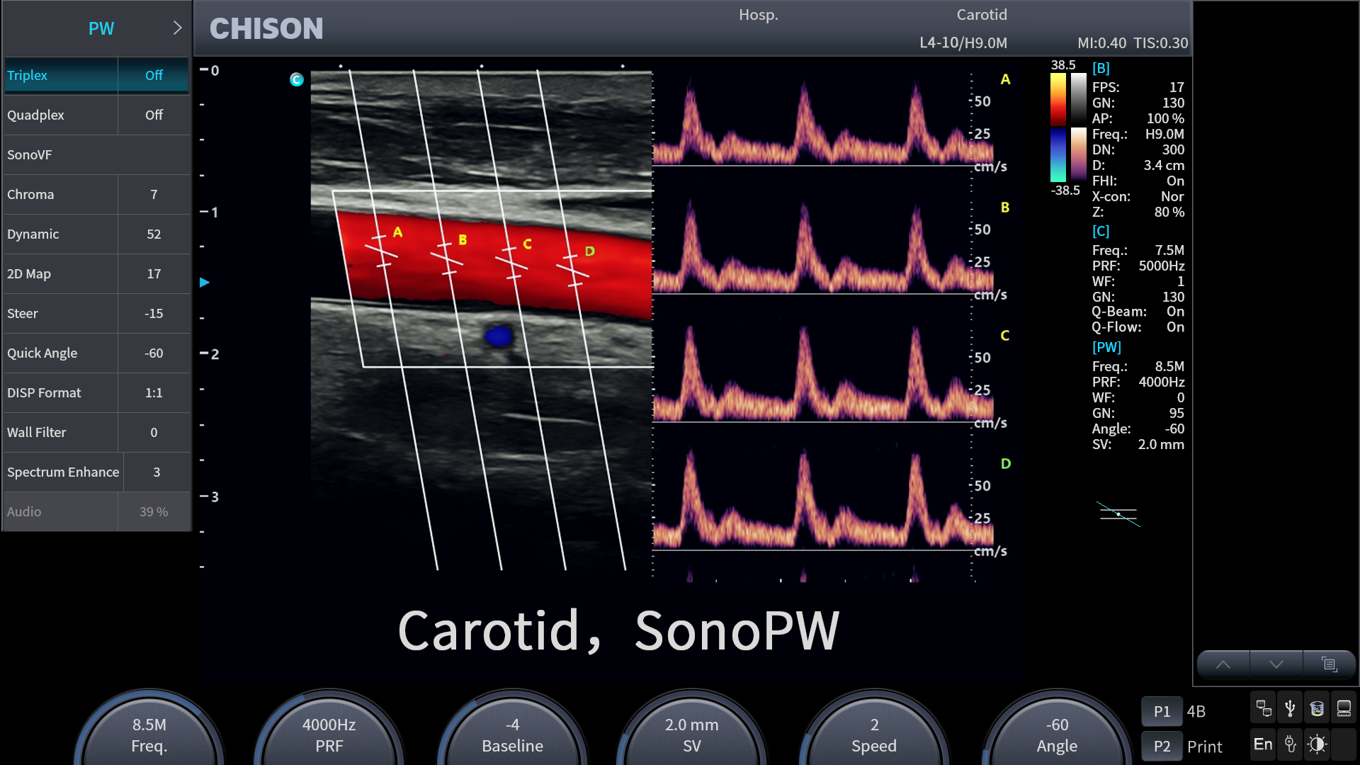 What Is a 3-in-1 Ultrasound System—and How Does It Improve Clinical Workflow?cid=67
