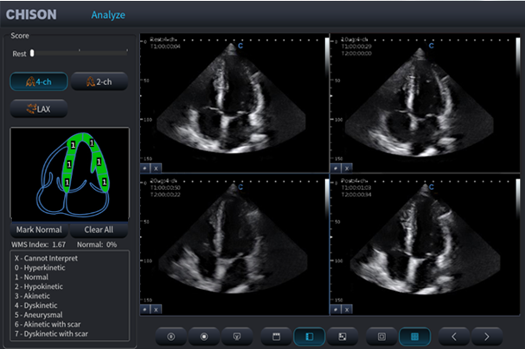 What Is a 3-in-1 Ultrasound System—and How Does It Improve Clinical Workflow?cid=67