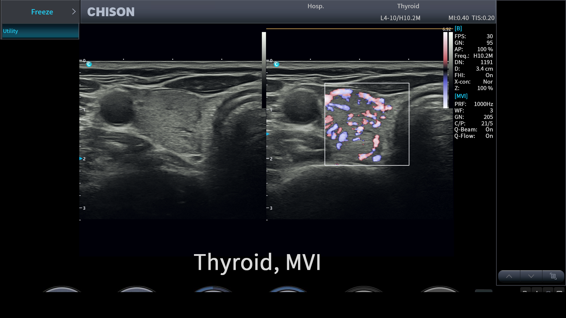 What Is a 3-in-1 Ultrasound System—and How Does It Improve Clinical Workflow?cid=67