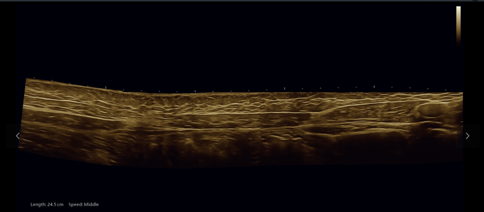 What Is a 3-in-1 Ultrasound System—and How Does It Improve Clinical Workflow?cid=67
