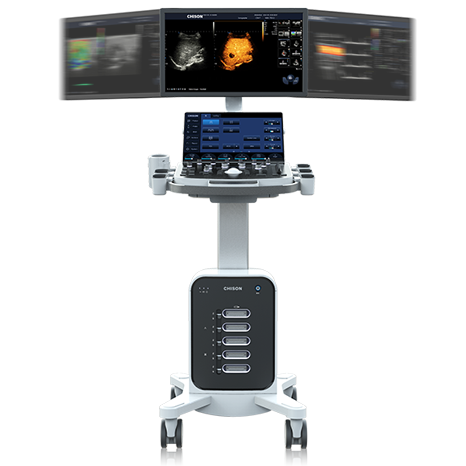 Liver Ultrasound: What It Shows, Benefits and Elastography