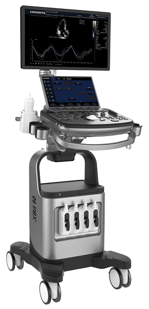 Liver Ultrasound: What It Shows, Benefits and Elastography