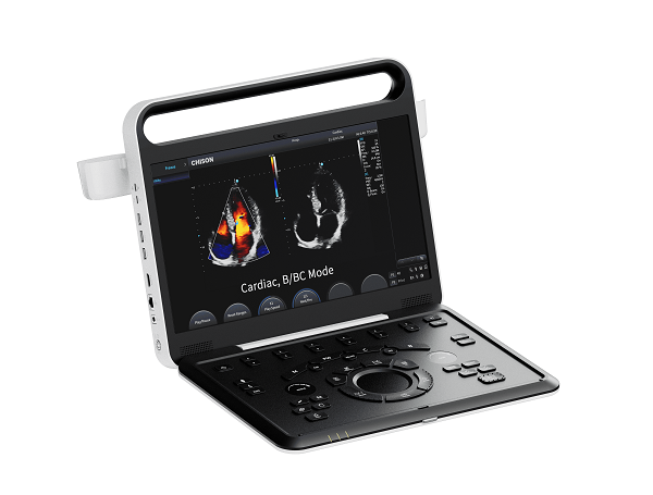 Portable Ultrasound Machines for Flexible Point-of-Care Imaging