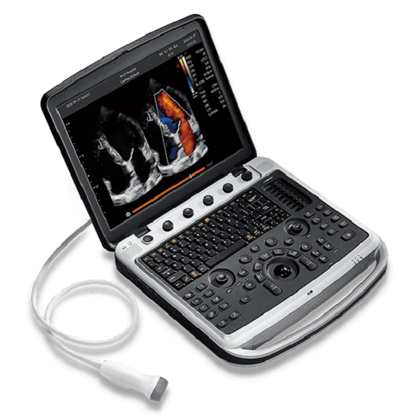Portable Ultrasound Machines for Flexible Point-of-Care Imaging