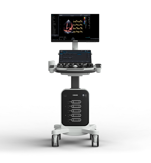 Humanitarian Aid | SonoMax Supports Cardiac Ultrasound in Spain