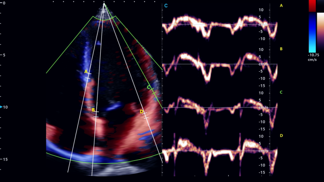 Humanitarian Aid | SonoMax Supports Cardiac Ultrasound in Spain