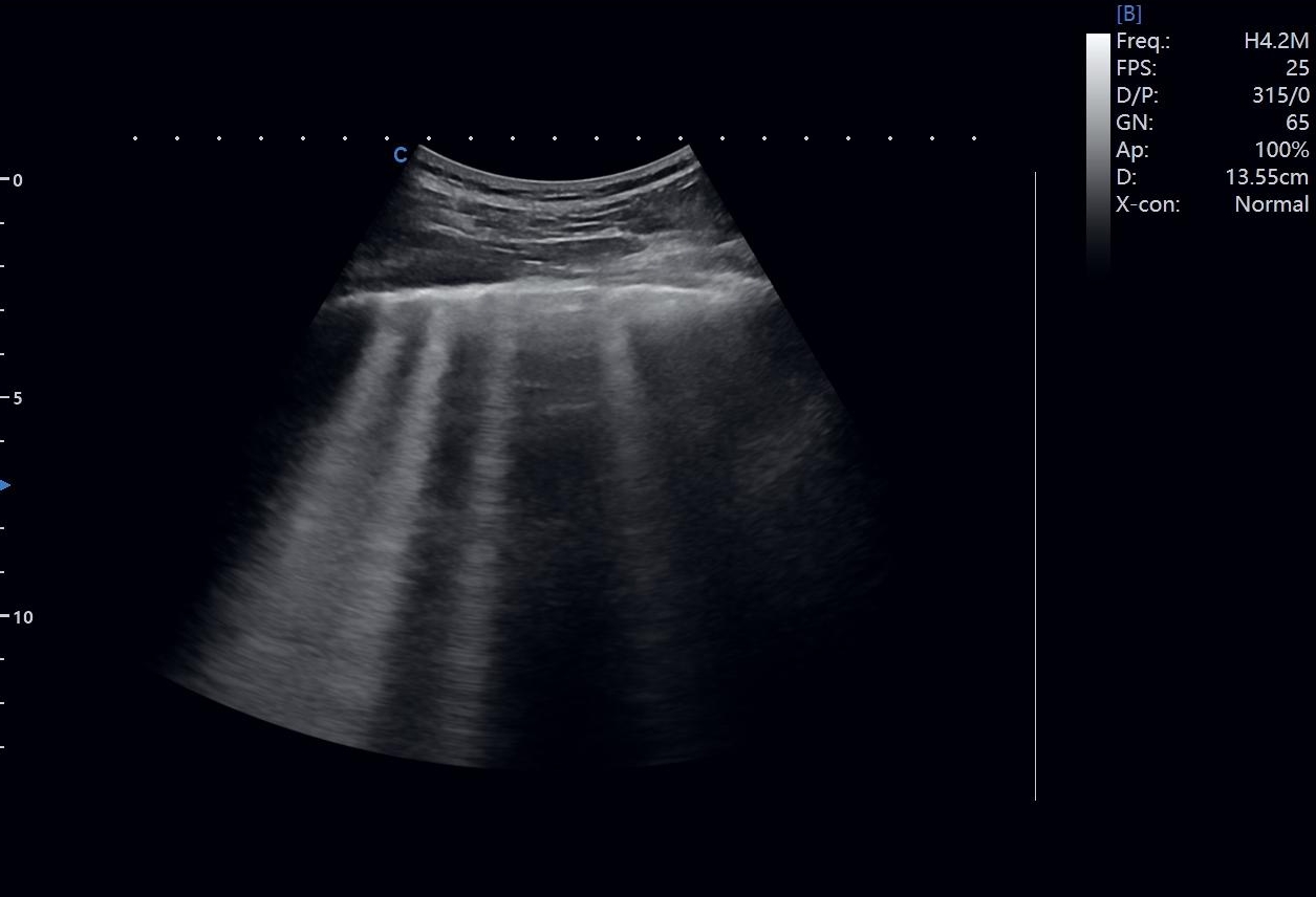 How Ultrasound Imaging Supports Point-of-Care and Emergency Medicine How Ultrasound Imaging Supports Point-of-Care and Emergency Medicine