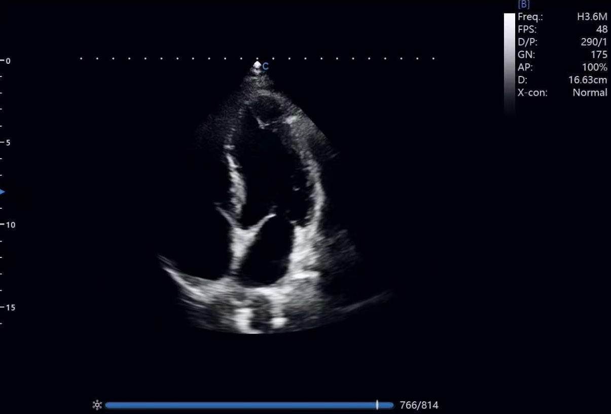 How Ultrasound Imaging Supports Point-of-Care and Emergency Medicine How Ultrasound Imaging Supports Point-of-Care and Emergency Medicine