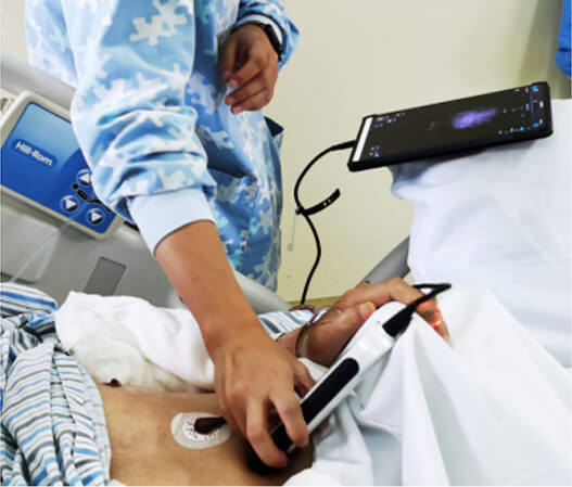 CHISON SonoEye in Asia CHISON SonoEye in Asia