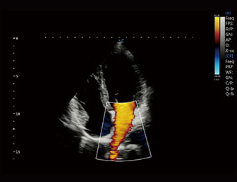 Cardiac，C Mode