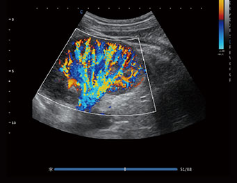 Kidney，C Mode