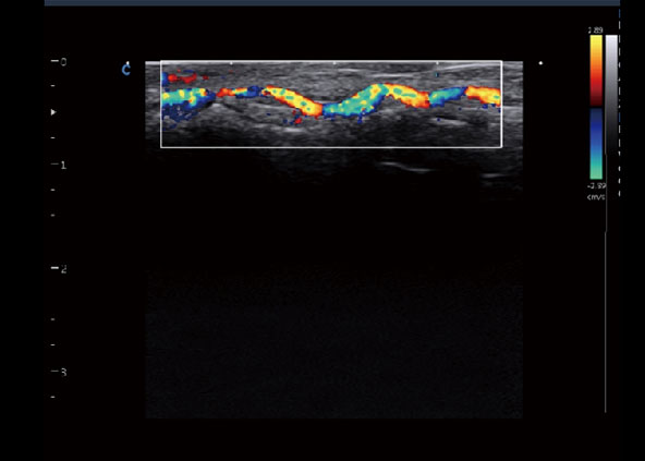 Fingertip blood flow, C Mode