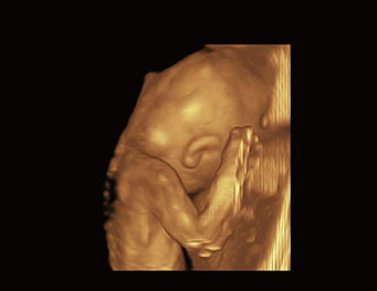 Fetal Body,4D Mode