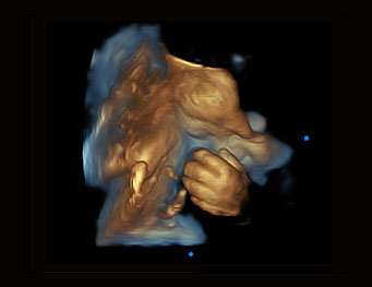 Fetal Hand,Depth View