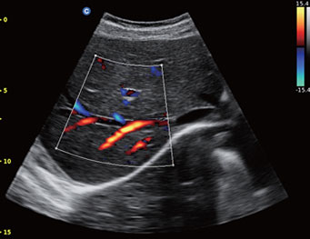 Liver, Color Mode Kidney, CPA