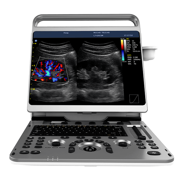 What is ultrasound equipment used for?