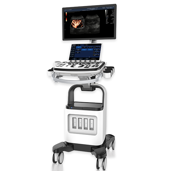 What Should I Look for When Buying an Ultrasound Machine?