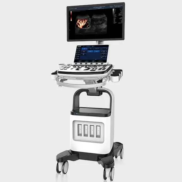 Cart-based Ultrasound