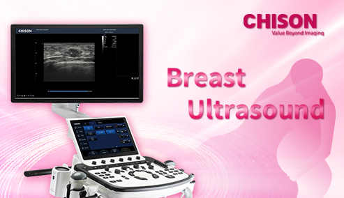 Can You Detect Breast Cancer with An Ultrasound?