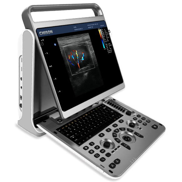 Portable Ultrasound Machine for Sale