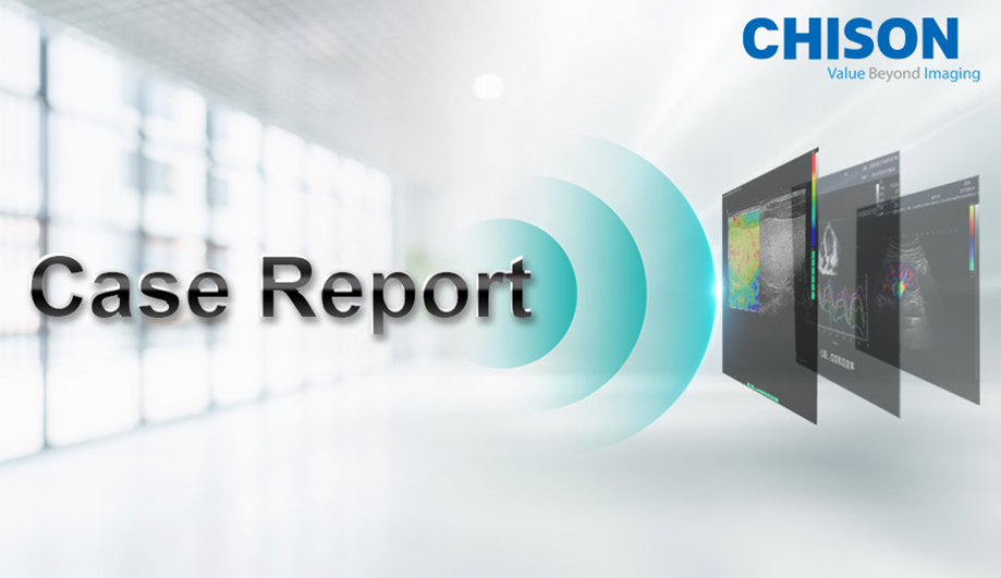 Case Report|A Case of Dilated Cardiomyopathy