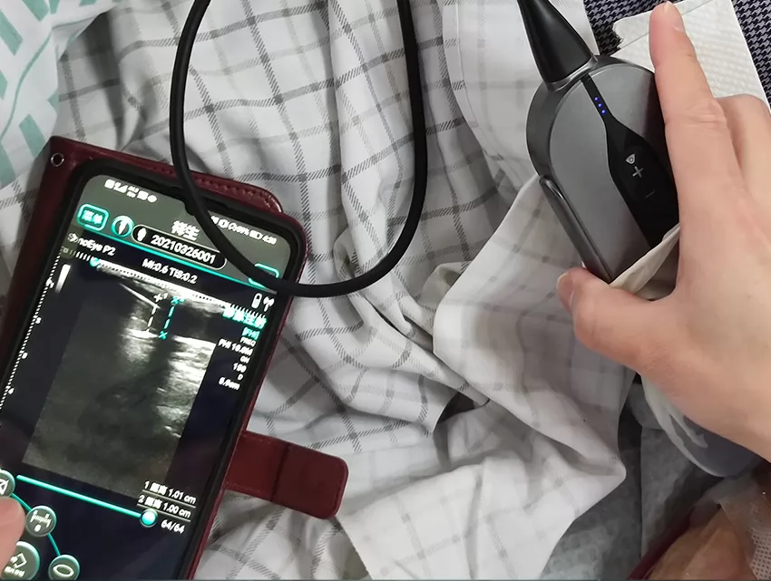 Make everyday operations in your clinic easier, faster and more intuitive. This elegant machine combines form and function with a lightweight magnesium alloy body and impressive image quality