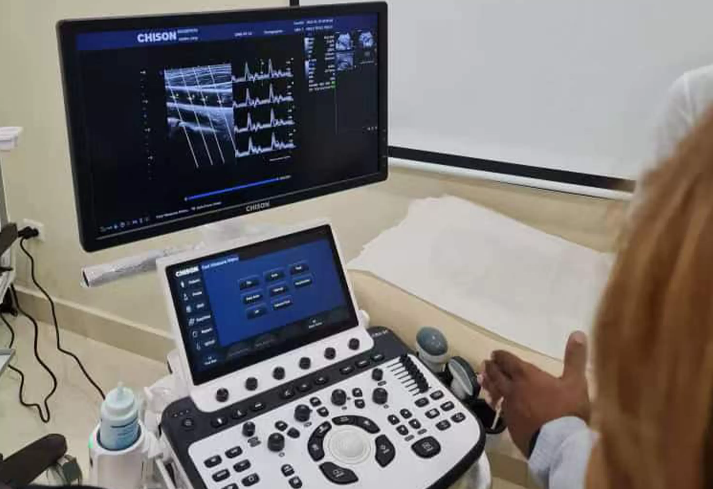 Advanced solutions for ultrasound bedside by improving efficiency and clinical quality with powerful portable ultrasound technology.