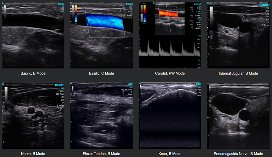 Are Handheld Ultrasounds Accurate?