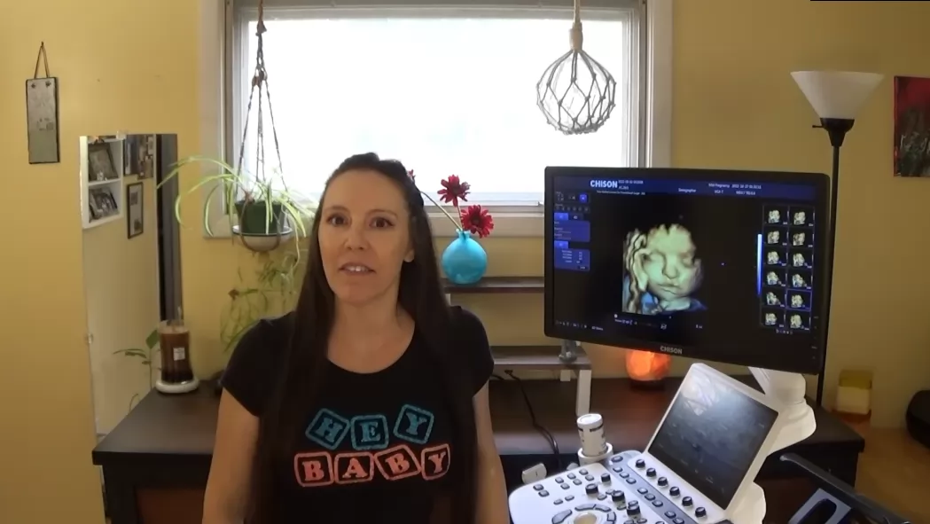 The 4D ultrasound machine is safe and non-invasive, using only sound waves to create the images without any harmful radiation.