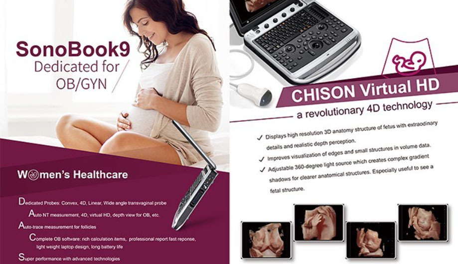CHISON Portable Ultrasound Machines Suitable for Various Clinical Applications