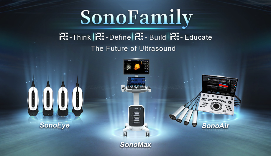 CHISON SonoFamily: A New Era of Ultrasound