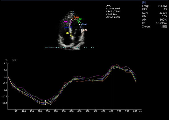 Strain and Strain Rate