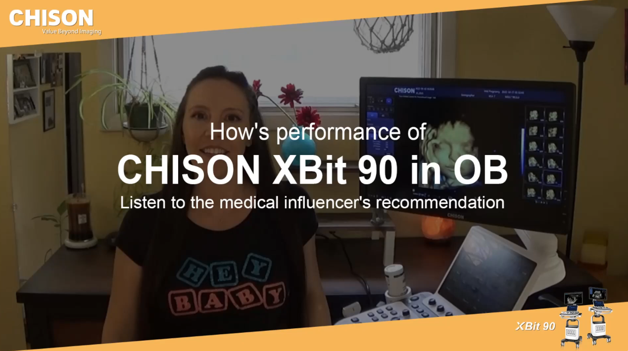 The performance of CHISON XBit 90 in OB