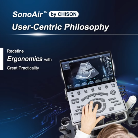 How does CHISON SonoAir Redefine the Future of Portable Ultrasound?