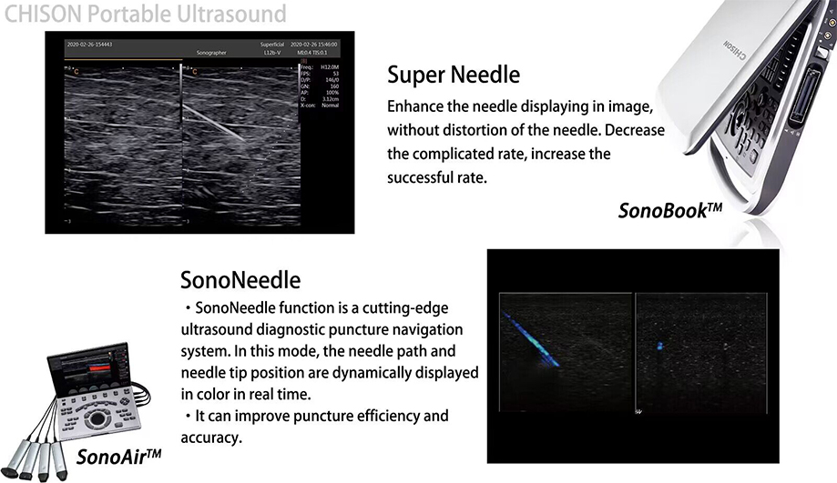 Top Ten Tips for Ultrasound-Guided Joint Injections