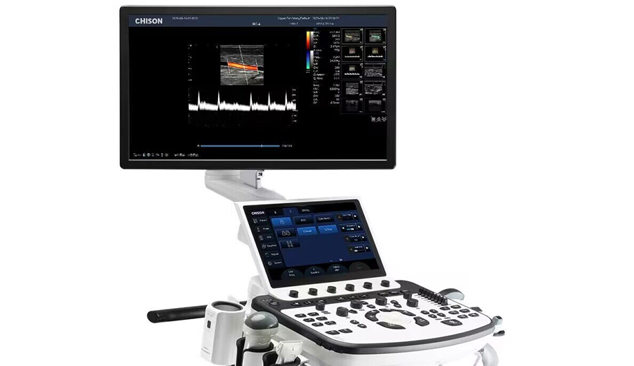XBit 90: Elevating Imaging Excellence with Premium Ultrasound Technology