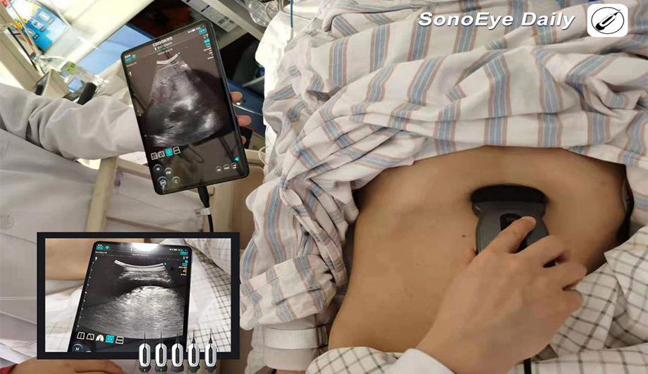 What is the Use of a Pocket-Size Handheld Ultrasound Machine in Emergency Medicine?