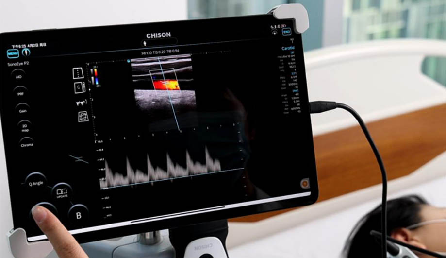 How Can Handheld Ultrasound Improve Patient Experience?