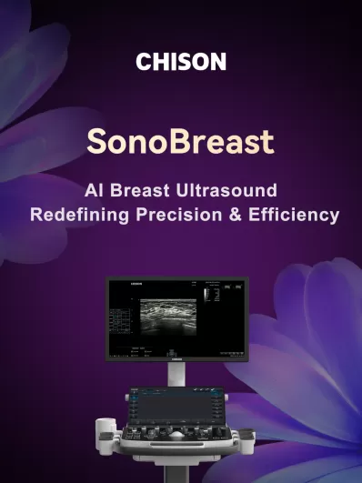 SonoBreast: Redefining Breast Ultrasound with AI