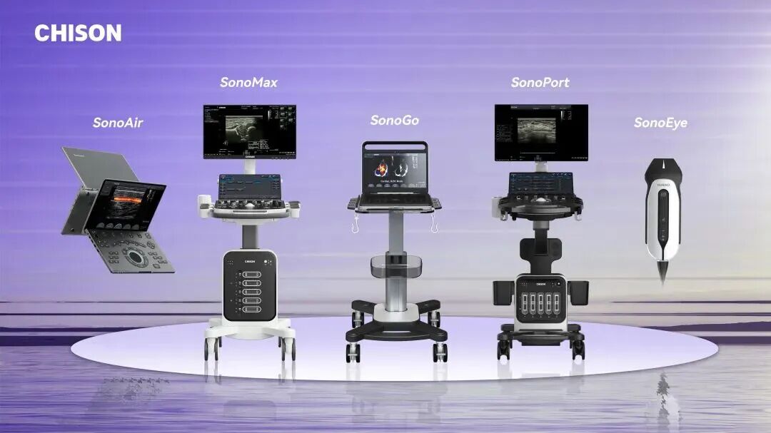 CHISON at ECR 2026 | AI Innovation Lighting the Future of Ultrasound