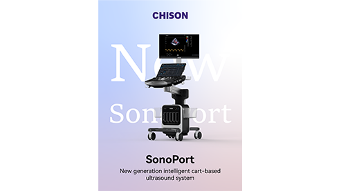CHISON SonoPort | New Generation intelligent Cart-based Ultrasound System