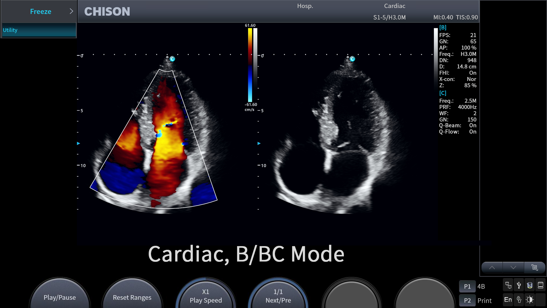 Cardiac, BBC