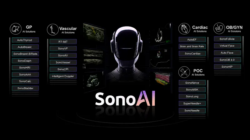 Intelligent Ultrasound Platform